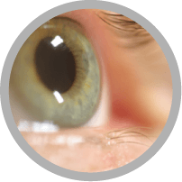 anteojos